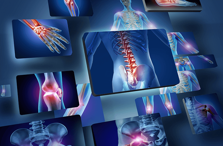 Orthopedic Hospitals